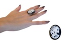 Ring skelet